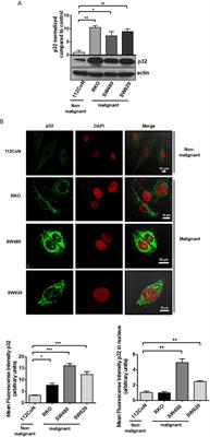 Overexpression of Multifunctional Protein p32 Promotes a Malignant Phenotype in Colorectal Cancer Cells